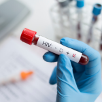 การตรวจ hiv