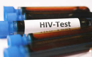 การตรวจ hiv test